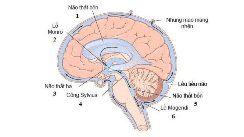 Nang màng nhện có nguy hiểm không? Tìm hiểu triệu chứng, nguy cơ và cách điều trị