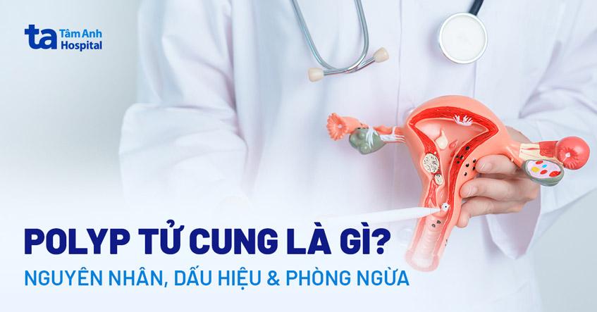 polyp tử cung