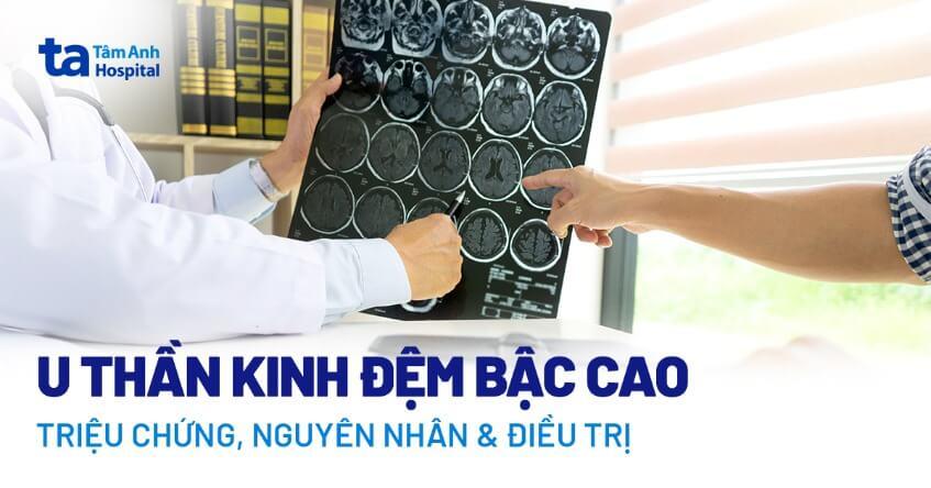 U thần kinh đệm bậc cao: Triệu chứng, nguyên nhân và điều trị