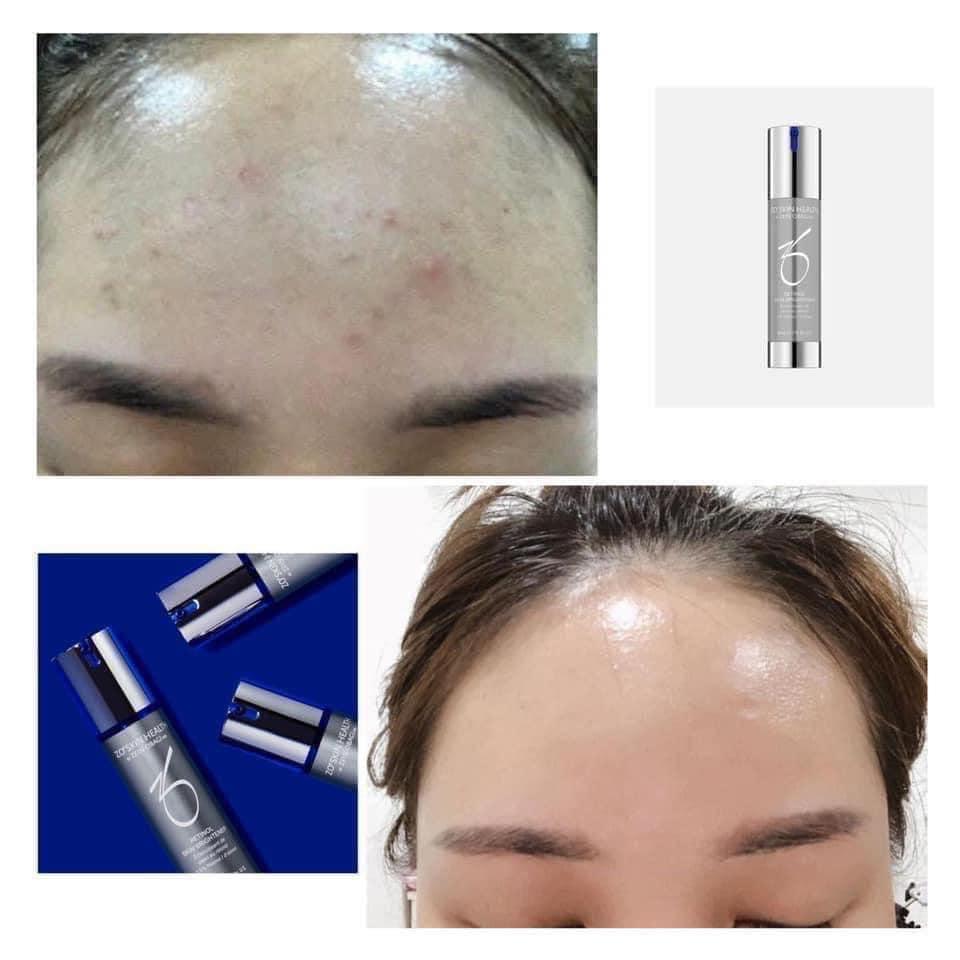 Kem Dưỡng Zo Retinol 0.5% (50ml) nhập khẩu USA