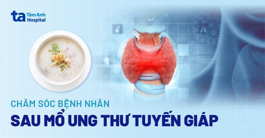 Hướng dẫn chăm sóc bệnh nhân sau mổ ung thư tuyến giáp đúng cách