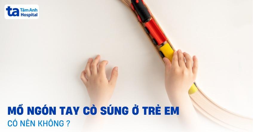 Mổ ngón tay cò súng ở trẻ em có nên không? Khi nào phẫu thuật?