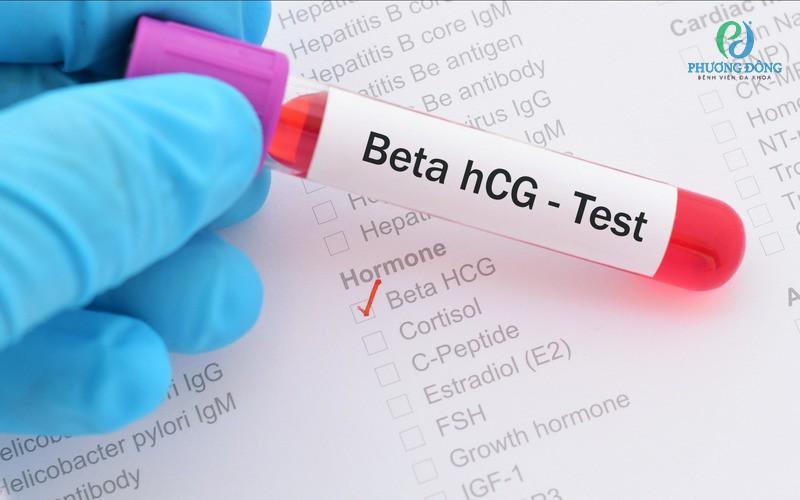 Điểm qua các mốc khám thai IVF quan trọng mẹ bầu cần biết