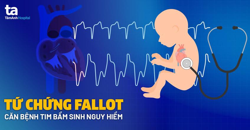 Tứ chứng Fallot (Fallot 4): Nguyên nhân, dấu hiệu và biến chứng