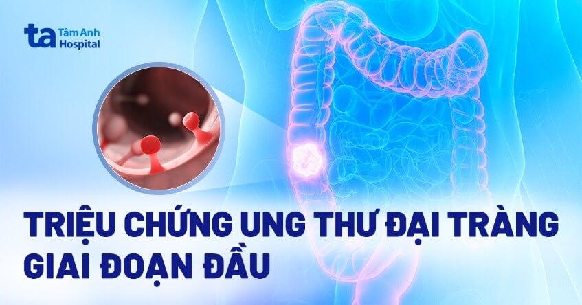 triệu chứng ung thư đại tràng giai đoạn đầu