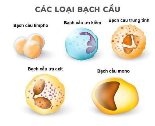 Các dạng bệnh bạch cầu thường gặp