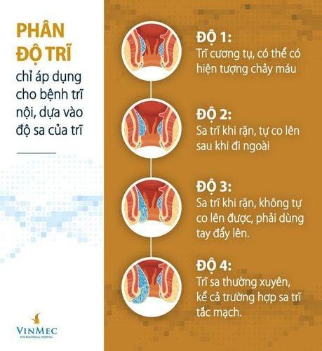 Tổng hợp những điều bạn cần biết về bệnh trĩ nội