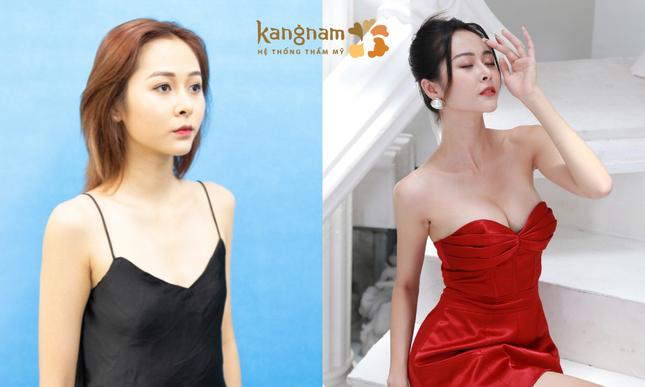 Vì sao Thẩm mỹ viện Kangnam được nhiều người nổi tiếng đến làm đẹp? ảnh 1