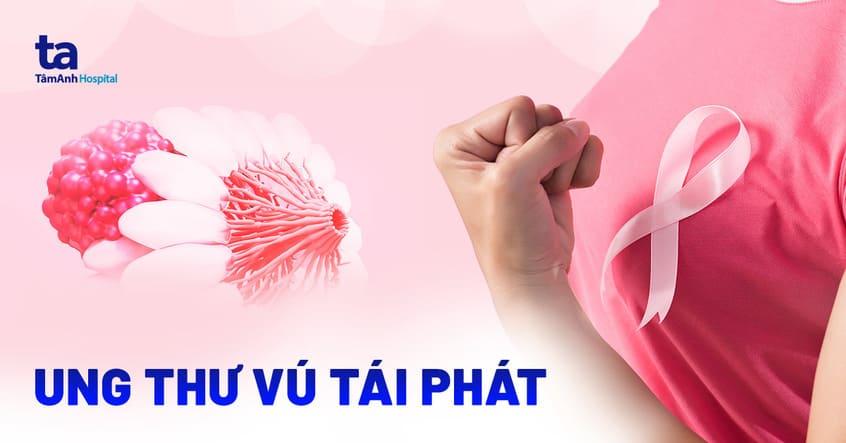 Ung thư vú tái phát: Dấu hiệu, nguyên nhân và cách phòng ngừa