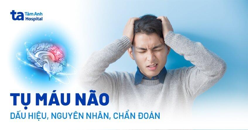 Tụ máu não: Dấu hiệu, nguyên nhân, chẩn đoán và phòng tránh