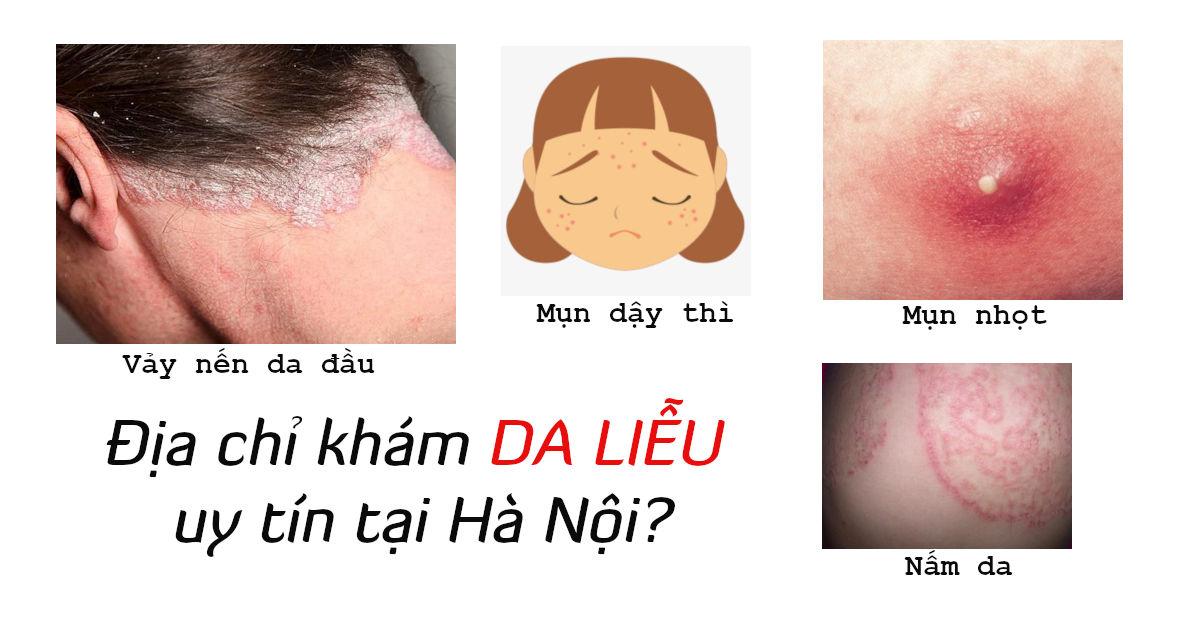 Bệnh viện, phòng khám Da liễu uy tín tại Hà Nội