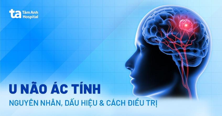 U não ác tính: Dấu hiệu, nguyên nhân và cách chẩn đoán bệnh