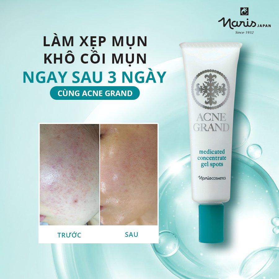 Gel trị mụn Naris Acne Grand Medicated Concentrate Gel Spots
