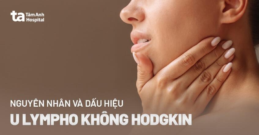 U lympho không hodgkin: Dấu hiệu, nguyên nhân và cách điều trị