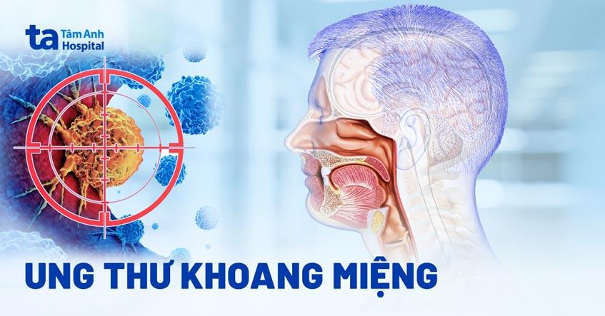 Ung thư khoang miệng: Nguyên nhân, dấu hiệu, chẩn đoán