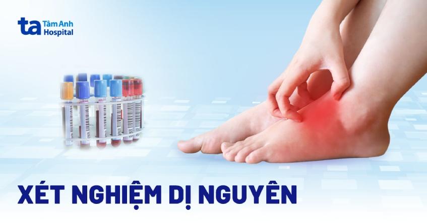 Xét nghiệm dị nguyên là gì? Khi nào cần thực hiện? An toàn không?