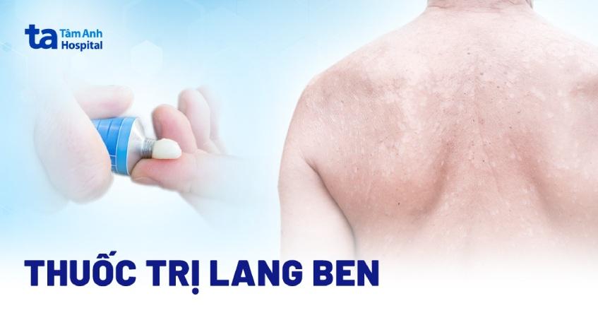 thuốc trị lang ben