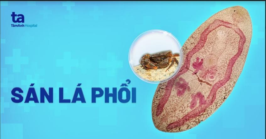 sán lá phổi