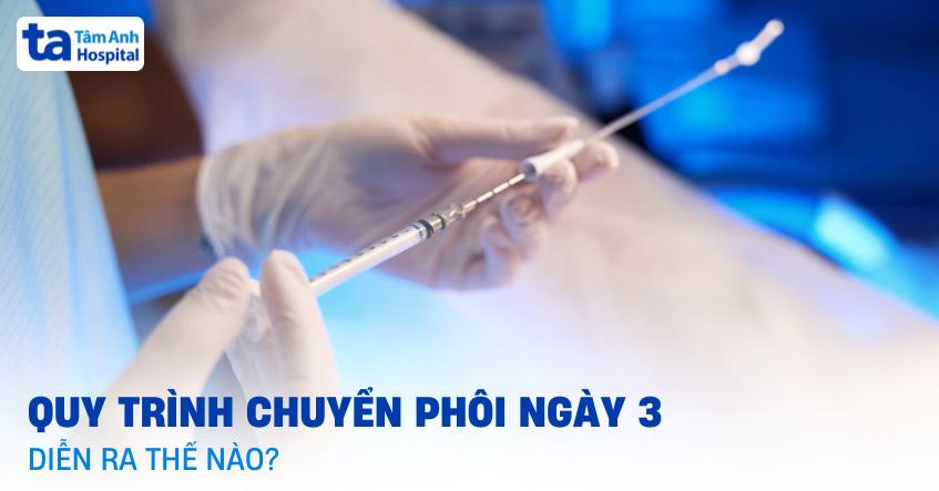 Chuyển phôi ngày 3 là gì? Chỉ định, ưu điểm và quy trình [A-Z]