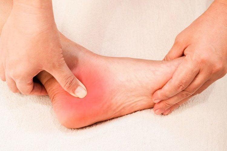 Đau gót chân là biểu hiện bệnh gì? Phải làm sao?