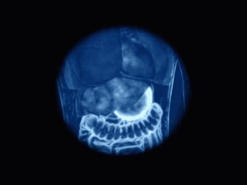 Hệ tiêu hóa ở người gồm những gì - xem hình ảnh tiêu hóa ở từng bộ phận